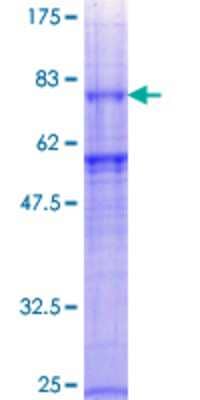 12.5% SDS-PAGE Stained with Coomassie Blue.