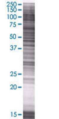 GALNT1 transfected lysate.