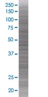 Other Polypeptide GalNac Transferase 3/GALNT3 293T Cell Transient Overexpression Lysate