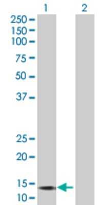 Lane 1: GALNT3 transfected lysate (15.9 KDa). Lane 2: Non-transfected lysate.