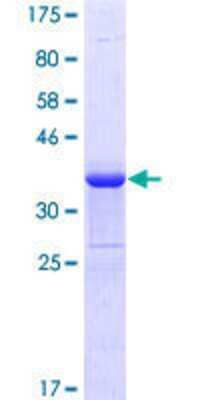 12.5% SDS-PAGE Stained with Coomassie Blue.