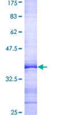 12.5% SDS-PAGE Stained with Coomassie Blue.