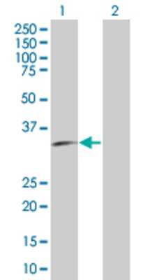 Lane 1: GLRB transfected lysate (56.1 KDa). Lane 2: Non-transfected lysate.