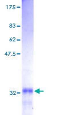 12.5% SDS-PAGE Stained with Coomassie Blue.