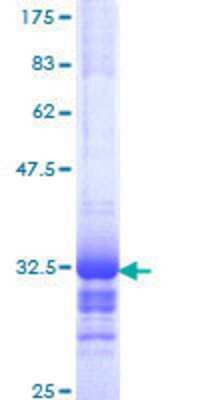 12.5% SDS-PAGE Stained with Coomassie Blue.