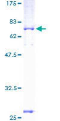 12.5% SDS-PAGE Stained with Coomassie Blue.