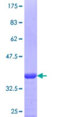 12.5% SDS-PAGE Stained with Coomassie Blue.