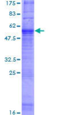 12.5% SDS-PAGE Stained with Coomassie Blue.