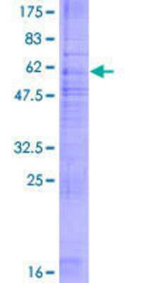 12.5% SDS-PAGE Stained with Coomassie Blue.