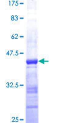 GRK4 Research Products: Novus Biologicals