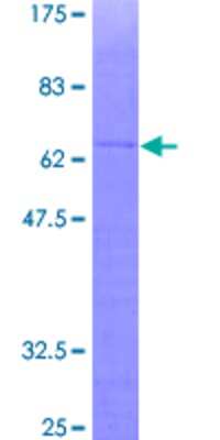 SDS-Page: Recombinant Human GPS2 Protein [H00002874-P01] - 12.5% SDS-PAGE Stained with Coomassie Blue.