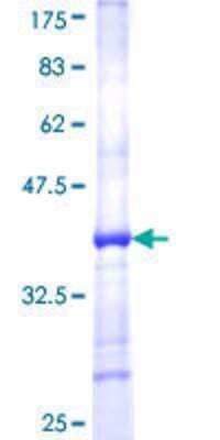 SDS-Page: Recombinant Human Glutathione Peroxidase 5 Protein [H00002880-Q01] - 12.5% SDS-PAGE Stained with Coomassie Blue.