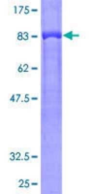 SDS-PAGE Recombinant Human GRB7 GST (N-Term) Protein