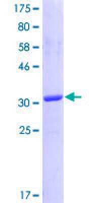 12.5% SDS-PAGE Stained with Coomassie Blue.