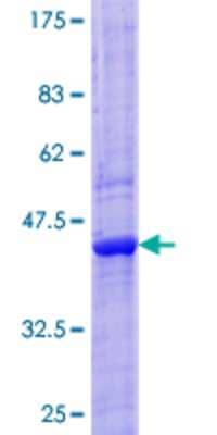 12.5% SDS-PAGE Stained with Coomassie Blue.