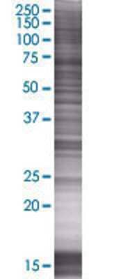 GSTZ1 transfected lysate.