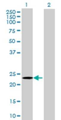 Lane 1: GSTZ1 transfected lysate (23.87 KDa) Lane 2: Non-transfected lysate.