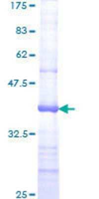 SDS-PAGE Recombinant Human MSH6 GST (N-Term) Protein