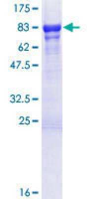 12.5% SDS-PAGE Stained with Coomassie Blue.