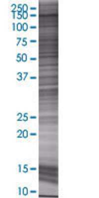 GTF2I transfected lysate.