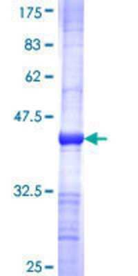 SDS-Page: Recombinant Human Guanylyl Cyclase alpha 2 Protein [H00002977-Q01] - 12.5% SDS-PAGE Stained with Coomassie Blue.
