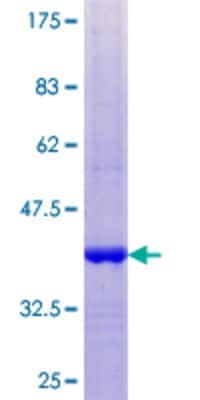 12.5% SDS-PAGE Stained with Coomassie Blue.