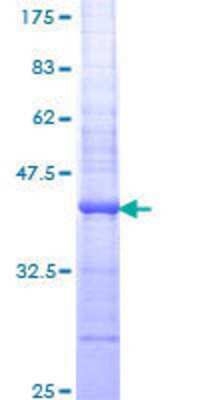 SDS-Page: Recombinant Human Guanylyl Cyclase alpha 1 Protein [H00002982-Q01] - 12.5% SDS-PAGE Stained with Coomassie Blue.