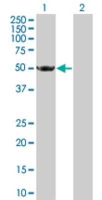 Lane 1: HARS transfected lysate (57.4 KDa) Lane 2: Non-transfected lysate.