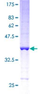 12.5% SDS-PAGE Stained with Coomassie Blue.