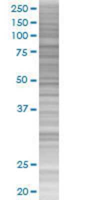 HCLS1 transfected lysate.