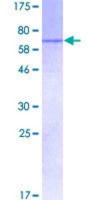 12.5% SDS-PAGE Stained with Coomassie Blue.