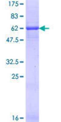 Other Recombinant Human Complement Factor H-related 1/CFHR1/CFHL1 GST (N-Term) Protein