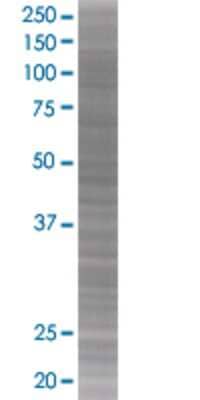 HIF1A transfected lysate.