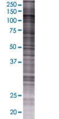 HIP1 transfected lysate.