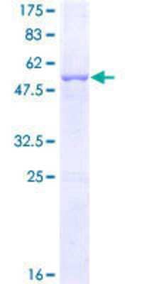 12.5% SDS-PAGE Stained with Coomassie Blue.