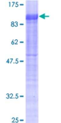 12.5% SDS-PAGE Stained with Coomassie Blue.