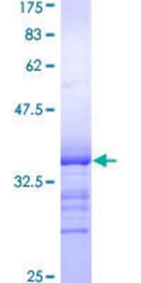 12.5% SDS-PAGE Stained with Coomassie Blue.