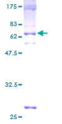 12.5% SDS-PAGE Stained with Coomassie Blue.