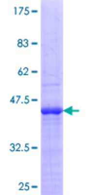 SDS-Page: Recombinant Human hnRNP U Protein [H00003192-Q01] - 12.5% SDS-PAGE Stained with Coomassie Blue.