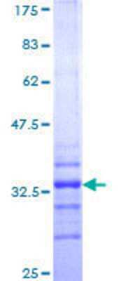 12.5% SDS-PAGE Stained with Coomassie Blue.