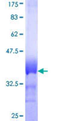 12.5% SDS-PAGE Stained with Coomassie Blue.