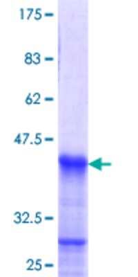 SDS-Page: Recombinant Human HOXB1 Protein [H00003211-Q02] - 12.5% SDS-PAGE Stained with Coomassie Blue.