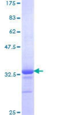 12.5% SDS-PAGE Stained with Coomassie Blue.