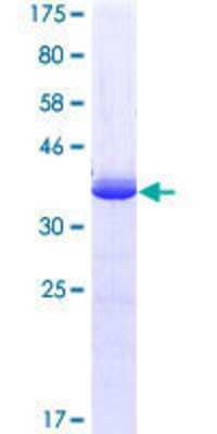 12.5% SDS-PAGE Stained with Coomassie Blue.