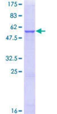 12.5% SDS-PAGE Stained with Coomassie Blue.