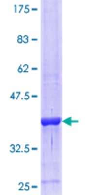 SDS-Page: Recombinant Human HSD11B2 Protein [H00003291-Q01] - 12.5% SDS-PAGE Stained with Coomassie Blue.