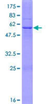 Other Recombinant Human HSD17B3 GST (N-Term) Protein