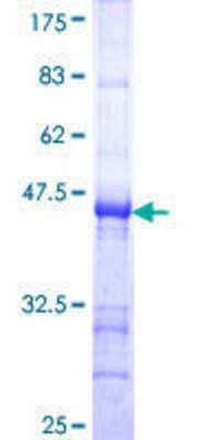 SDS-Page: Recombinant Human HSD17B2 Protein [H00003294-Q01] - 12.5% SDS-PAGE Stained with Coomassie Blue.