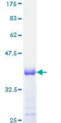 12.5% SDS-PAGE Stained with Coomassie Blue.