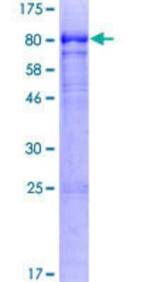 12.5% SDS-PAGE Stained with Coomassie Blue.